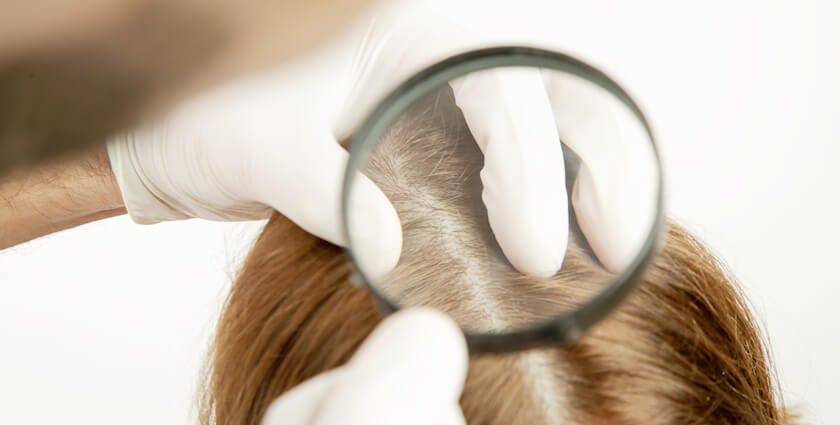 En hårbottenundersökning med förstoringsglas inför PRP-behandling eller hårtransplantation.
